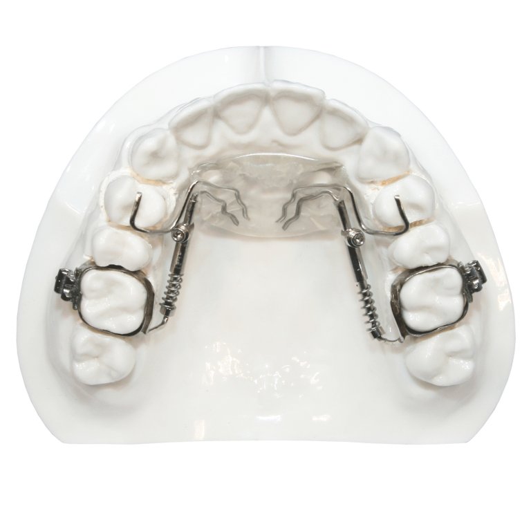 Distalizers | Five Star Orthodontic