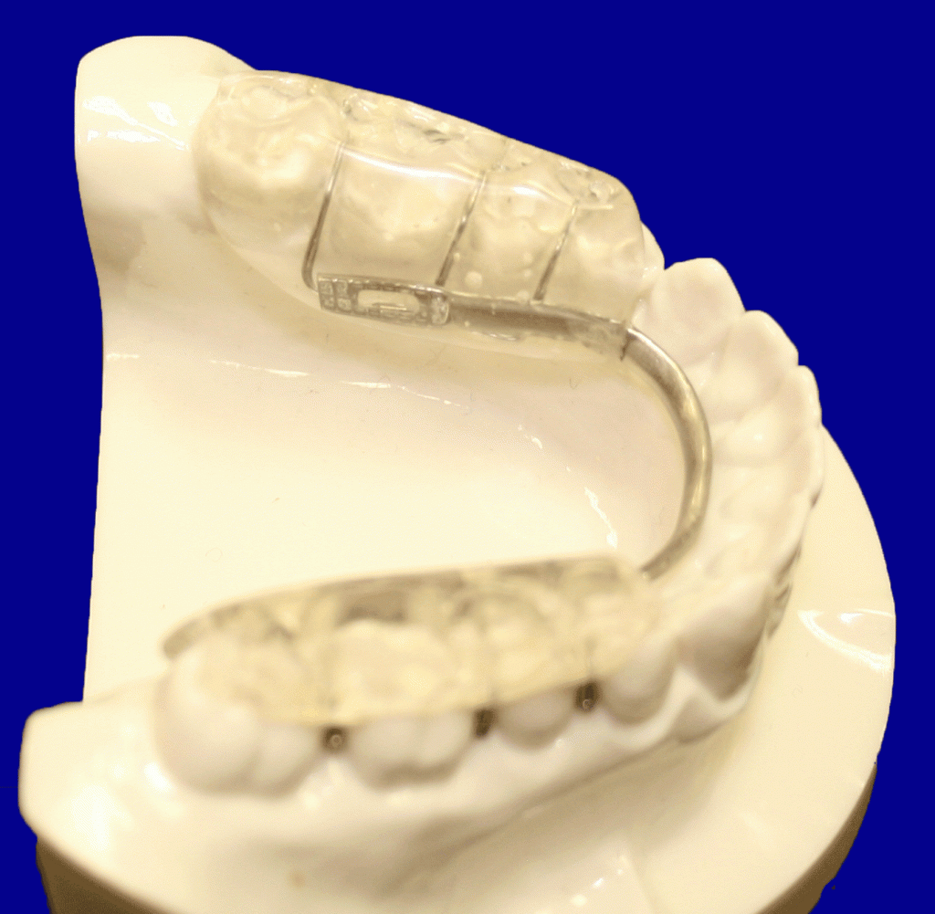 Gelb Five Star Orthodontic