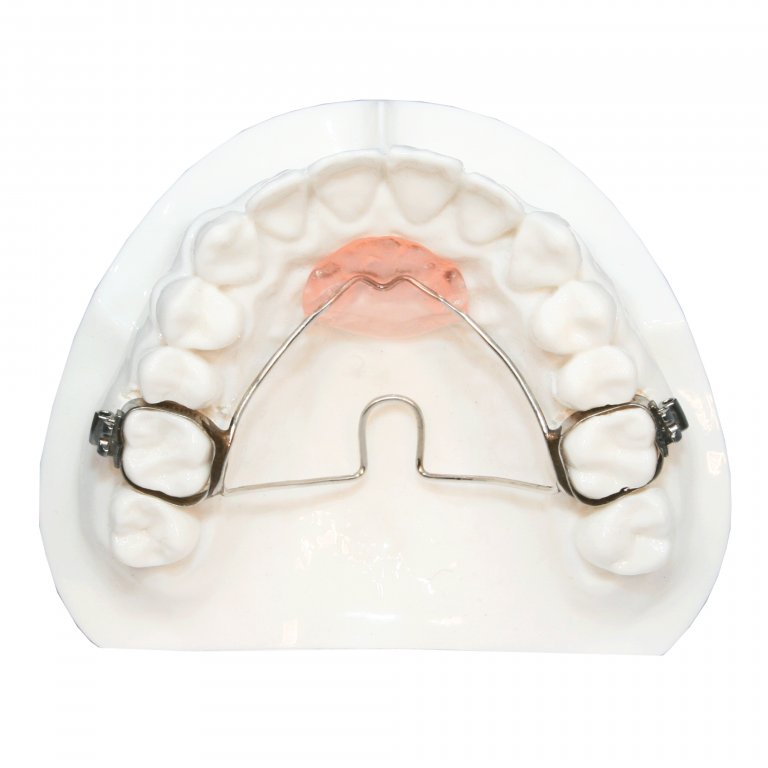 Retainers Five Star Orthodontic