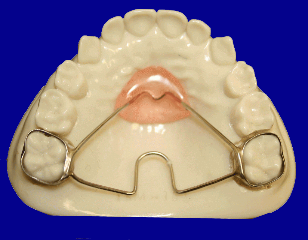 NanceTPA Five Star Orthodontic