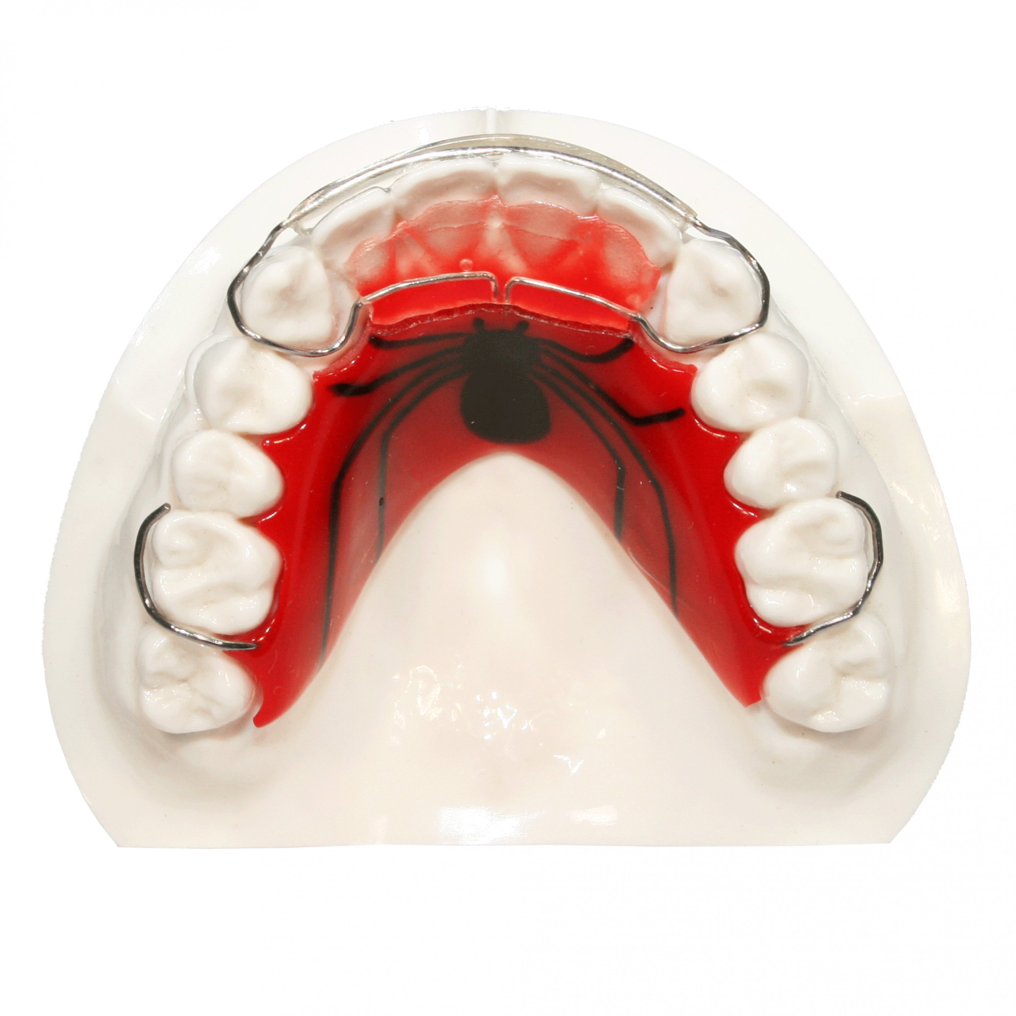 Retainers Five Star Orthodontic