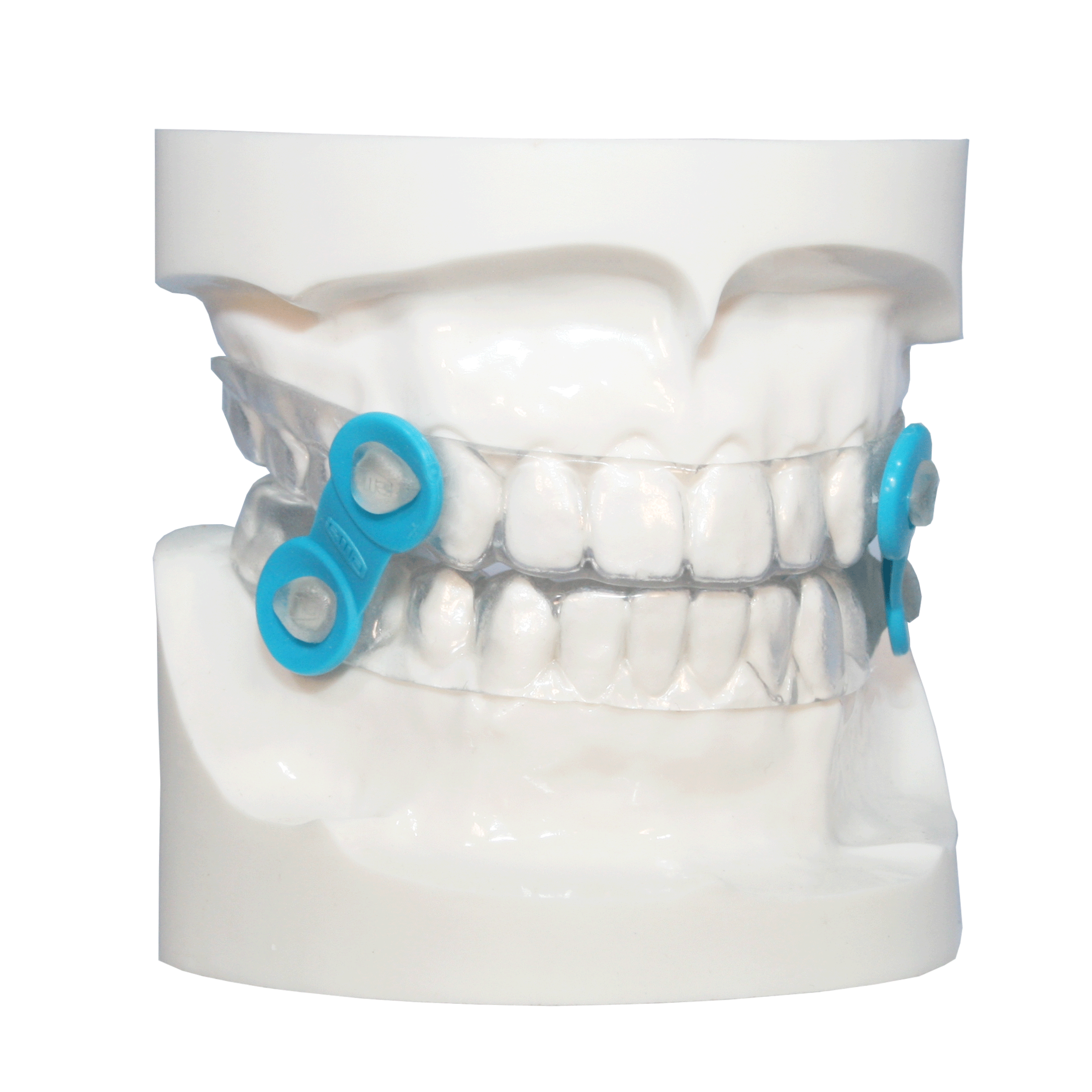 Class II Appliances  Five Star Orthodontic