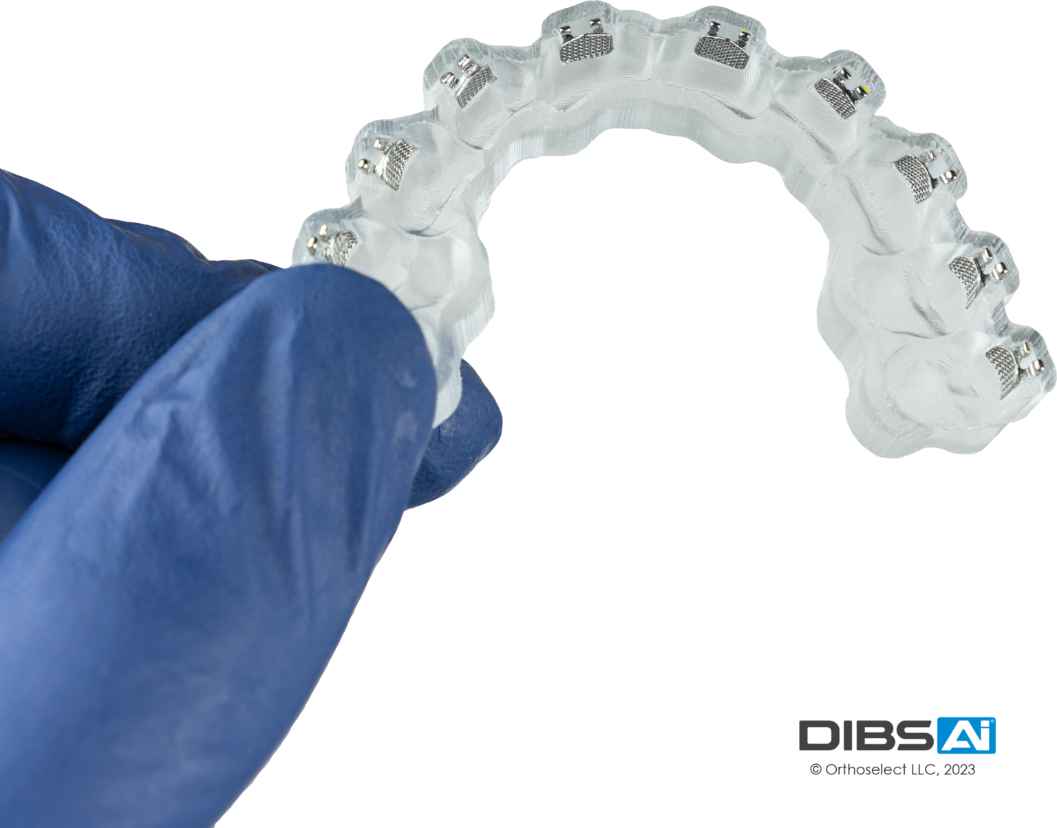 The Evolution of Bracket Bonding Fivestar Ortho