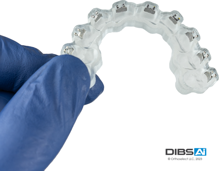 Revolutionize Your Orthodontic Treatment with Digital Indirect Bonding ...