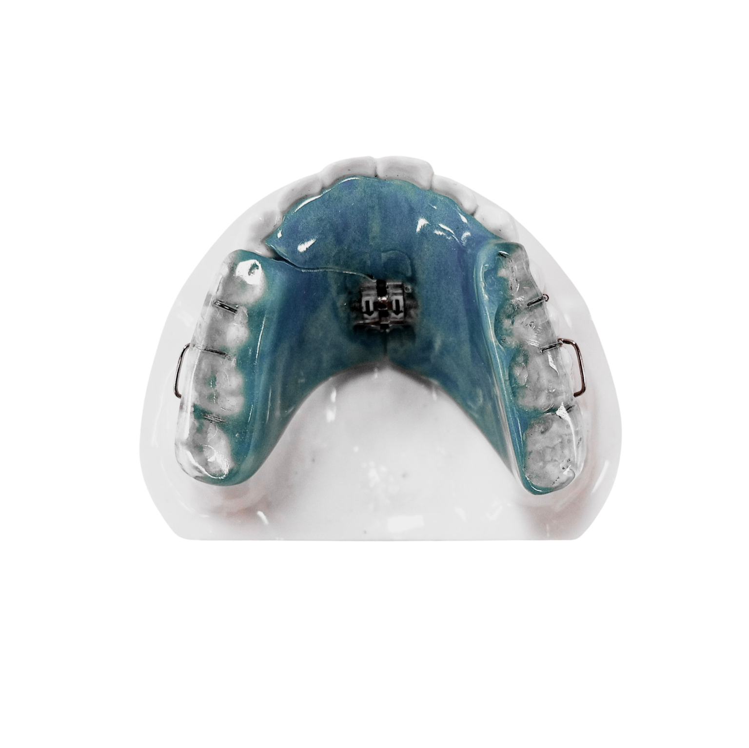 Nord cross bite - add to current one on expanders page 2 - Edited