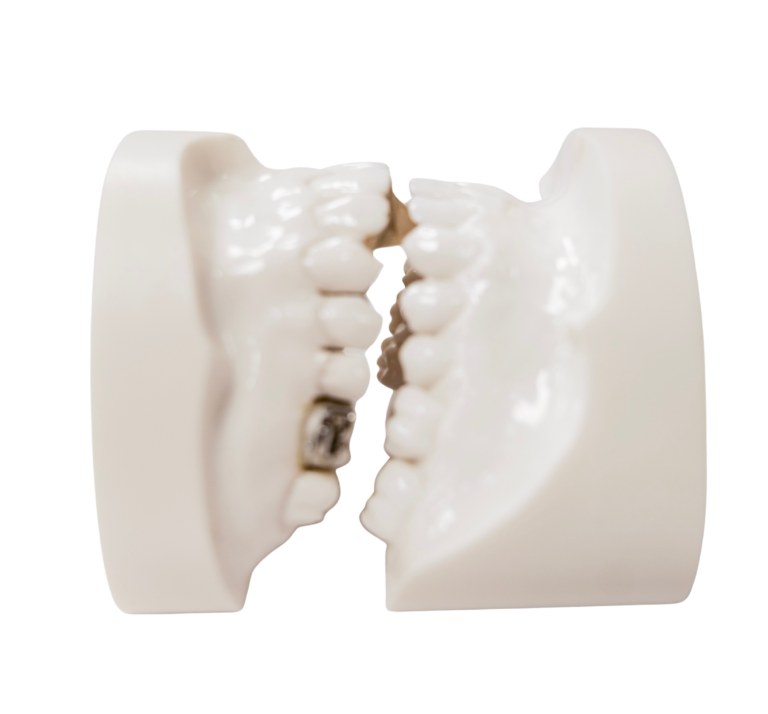 Rickonator add to current picture on class II appliance 2 - Edited