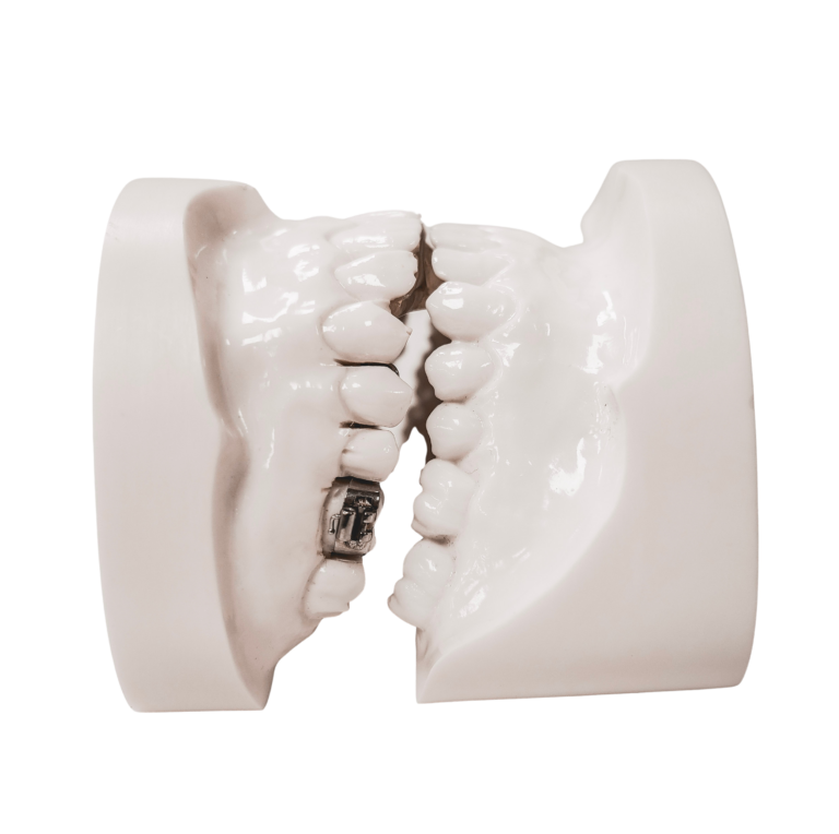 Rickonator add to current picture on class II appliance 3 - Edited