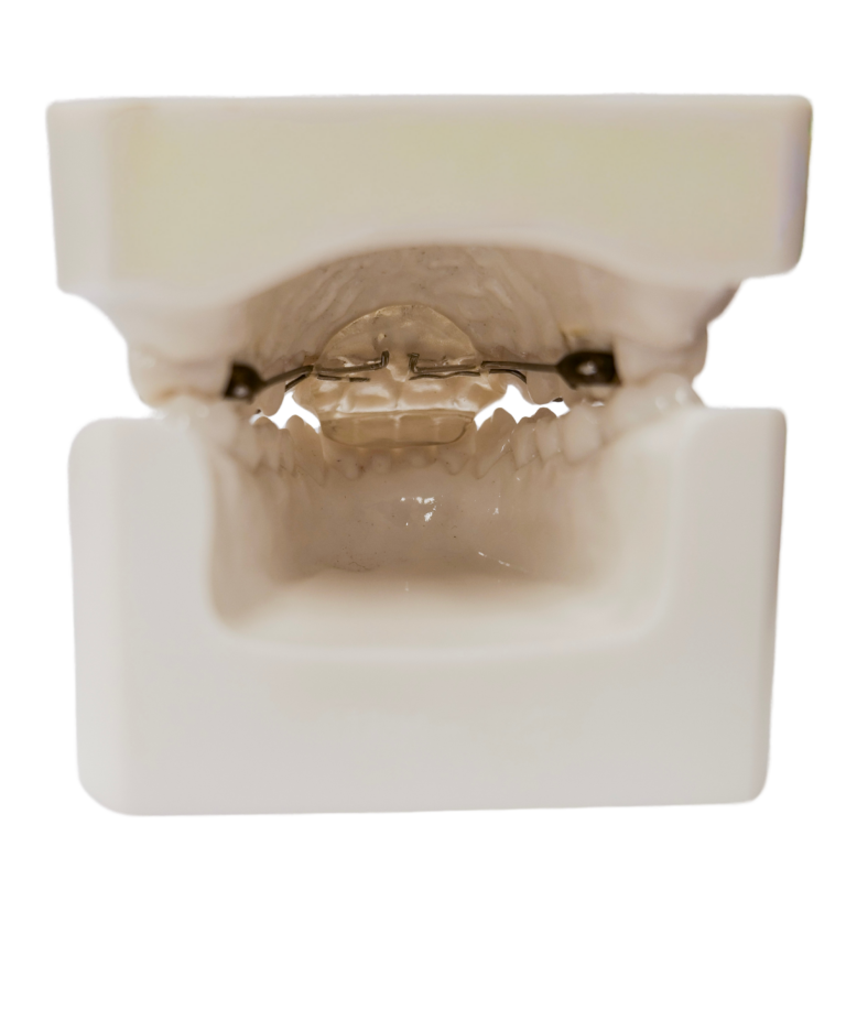 Rickonator add to current picture on class II appliance - Edited